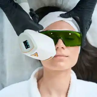 Депиляция лица